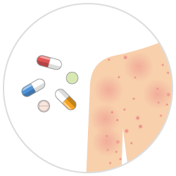 アトピー性皮膚炎（内服JAK阻害薬）のイメージアイコン